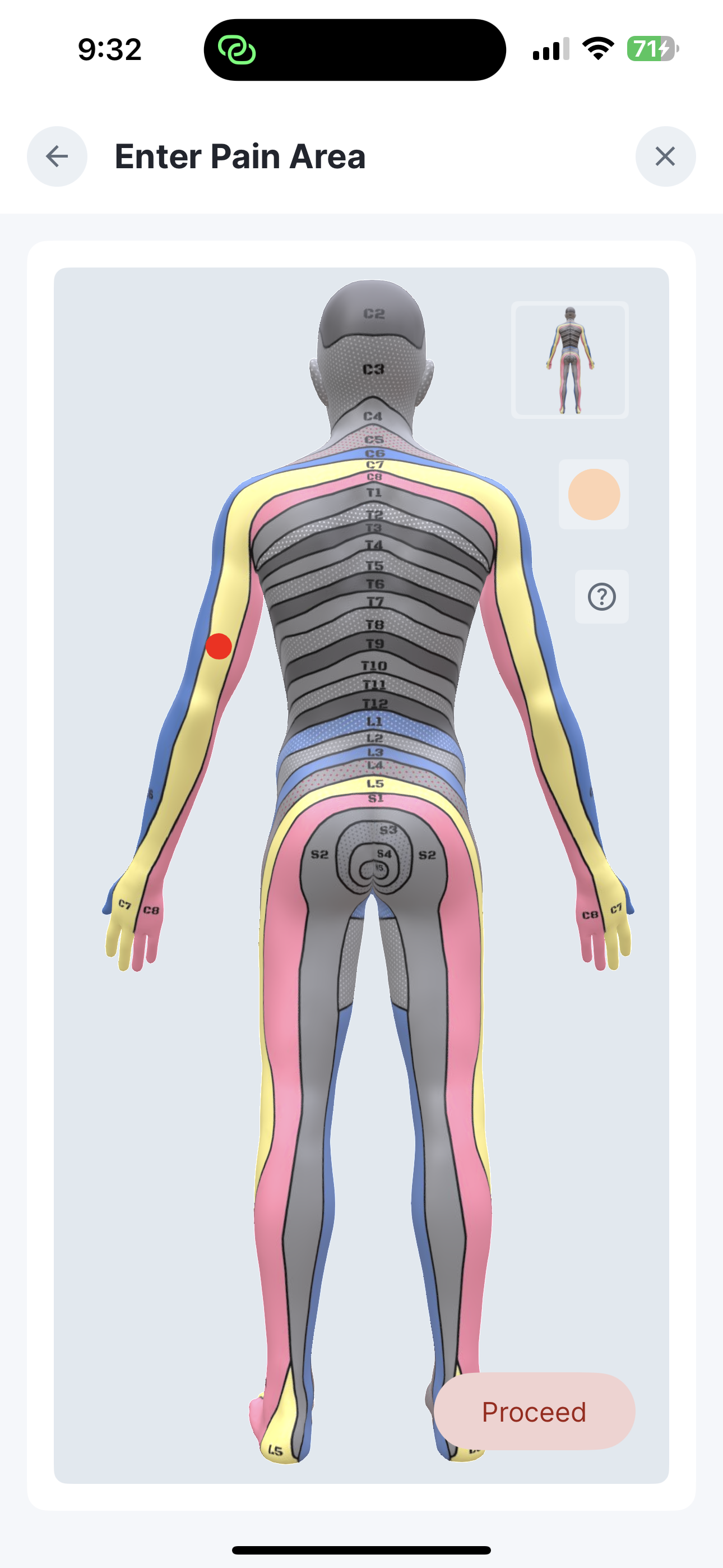 Dermatome View